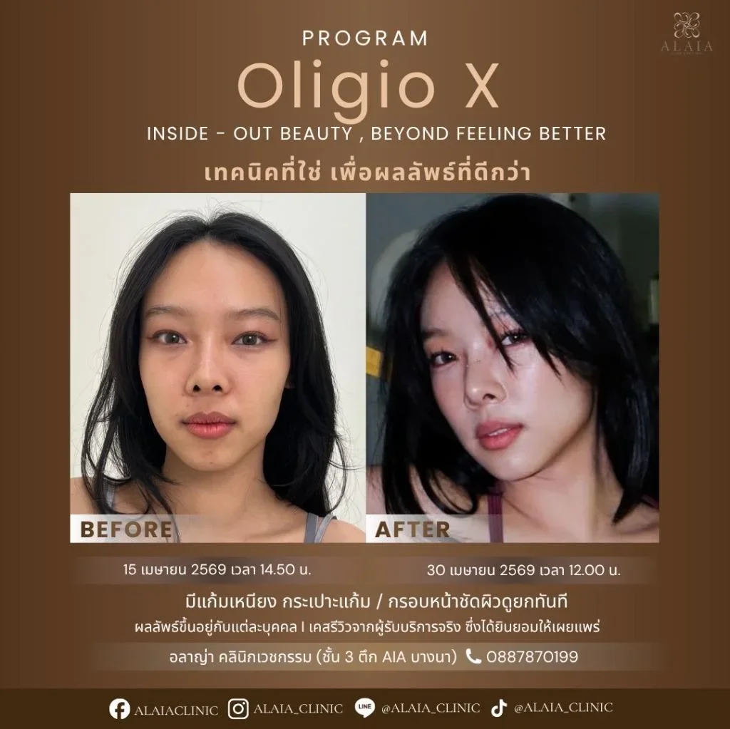 Program Oligio X Review
